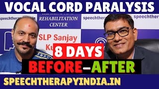 BeforeAfter  Unilateral Vocal Cord Paralysis Phonatory Gap  8 Days Treatment  slpsanjaykumar [upl. by Sofia916]