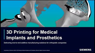 Additive Manufacturing for Medical Implants and Prosthetics [upl. by Norma]