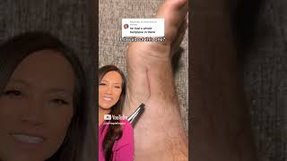 Dr Pimple Popper Reacts to Inflamed Ingrown That Looks SATISFYING to Pull Out [upl. by Wyndham]