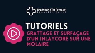 Tutoriel  Grattage et surfaçage dun Inlay Core sur une molaire [upl. by Notwal]