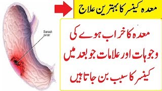 Stomach cancer causes Maida ka ilaj Maday ki bemari [upl. by Jacklyn279]