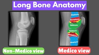 “Long Bone Anatomy Explained  Physis Epiphysis Metaphysis amp Diaphysis Overview” [upl. by Kcerb900]