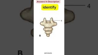 identify the parts of vertebrae Quiz  vertebral column anatomy quiz [upl. by Yelyak]