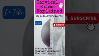 What do the Cervical Exam Numbers Mean pregnancy cervical pain [upl. by Whitehouse341]