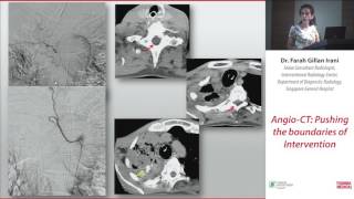 4 Angio CT Pushing the boundaries of Intervention  Dr Farah Gillan Irani [upl. by Esiuolyram]