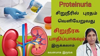 சிறுநீரில் புரதம் போவதால் காணப்படும் அறிகுறிகள் Proteinuria causes and symptoms [upl. by Hepzi]