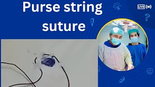 purse string suture  suture techniques and uses [upl. by Maon]