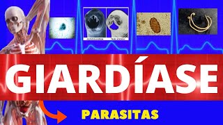 GIARDÍASE  GIARDIA LAMBLIA GIARDIA  PARASITOLOGIA INFECTOLOGIA  ENSINO SUPERIOR [upl. by Aihc918]