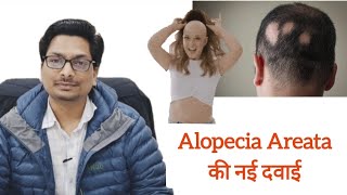 Alopecia Areata की नई दवाई  Tofacitinib  Baricitinib  Ruxolitinib  गंजापन का नया इलाज़ alopecia [upl. by Cayser728]