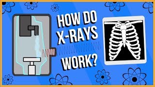 How do XRays Work [upl. by Janeta891]