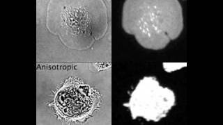 Isotropic and anisotropic spreading of fibroblasts [upl. by Asile]