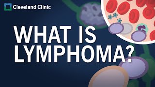 What Is Lymphoma [upl. by Assir]