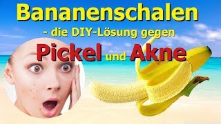 Bananenschalen  Die DIYLösung gegen Pickel und Akne [upl. by Kina]