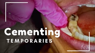 CEMENTING TEMPORARY CROWNS  PART 3  DA Tips [upl. by Weiman36]