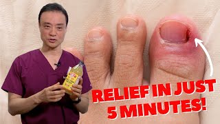 6 HOME REMEDIES To Treat A PAINFUL Ingrown Nail  Dr Kim [upl. by Enyrhtac]