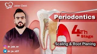 Periodontics   Scaling amp Root Planing [upl. by Boucher]