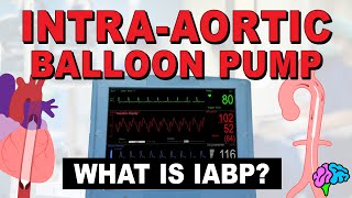 What is an IntraAortic Balloon Pump IABP [upl. by Otanod596]