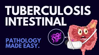 Intestinal Tuberculosis in 7 mins l Pathology Made Easy [upl. by Saxen]