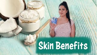 benefits of coconut oil for skin  Skincare with Coconut oil  How coconut oil helps with skin [upl. by Notsruht]