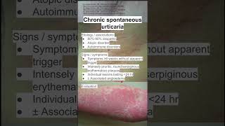 Chronic spontaneous urticaria [upl. by Sillsby]