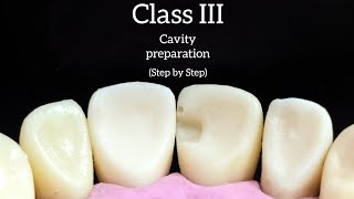 Class III cavity preparation step by step with explanation upper incisor  خطوة بخطوة مع الشرح [upl. by Anauq]