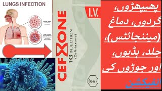 CEFXONE  CEFTRIAXONE cefxone 1g injection [upl. by Norman]