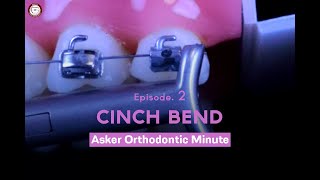 Cinch Bend Asker Orthodontic Minute Episode 2 [upl. by Attenyt]