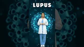 Systemic Lupus Erythematosus SLE Explained What You Need to Know lupus [upl. by Aniretak315]