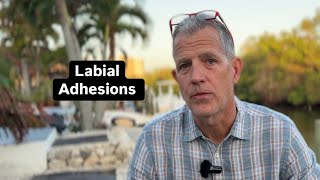 Labial Adhesions [upl. by Obe260]