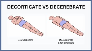 Decorticate vs Decerebrate Explained [upl. by Geoffrey]