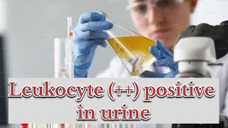 leukocytes positive in urine  symptoms causes  treatment [upl. by Nivlac462]