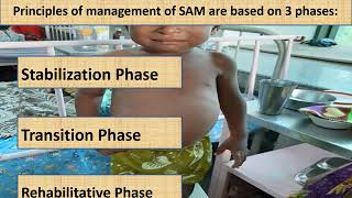 Severe Acute Malnutrition Part 14  Appetite test  Pediatrics [upl. by Leo473]