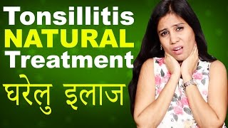 Tonsillitis Home Treatment │ टॉन्सिल्स का घरेलु इलाज │ Tonsils ka Gharelu Ilaj in Hindi │ Imam Dasta [upl. by Ecnaiva]