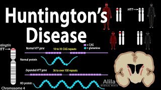 Huntingtons Disease Genetics Pathology and Symptoms Animation [upl. by Neetsyrk]