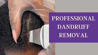 Watch me do Scalp Rejuvenation Therapy for DandruffDermatitisPsoriasis 😮 [upl. by Cerf]