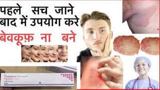 Topinate Cream Full Information In Hindi  Uses  Side effects  Dosage [upl. by Sarat]