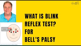 What is Blink reflex test [upl. by Yesrej919]