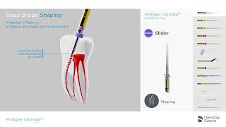 ProTaper Ultimate Endo File System  Shaping Sequence [upl. by Ytineres]