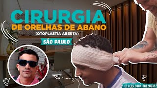 âœ… CIRURGIA DE ORELHAS COM O MELHOR PREÃ‡O DO BRASIL  OTOPLASTIA  ANTES E DEPOIS [upl. by Yahsat]