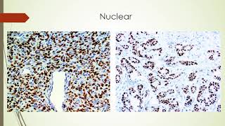 Immunohistochemical staining practical session [upl. by Urquhart202]