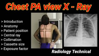 Chest PA View XRay  Posterior to Anterior view  part 1   By BL Kumawat [upl. by Amaerd187]