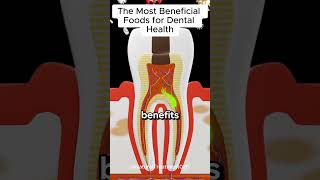 Vitamins and Minerals for Healthy Teeth and Gums short [upl. by Dnomasor]