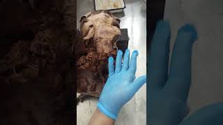 PAROTID GLAND dissection [upl. by Grant]