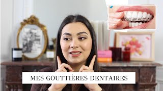 TOUT SAVOIR SUR MON TRAITEMENT DE GOUTTIÈRES DENTAIRES PRIX  ÇA MARCHE  DOULEUR [upl. by Anerual]