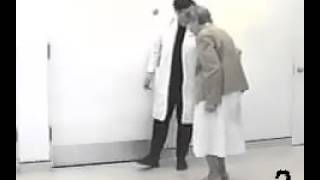 Parkinsonian shuffling gait [upl. by Earazed233]