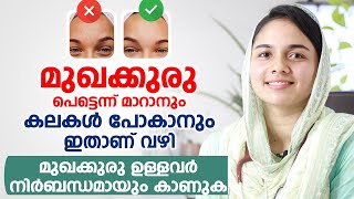 മുഖക്കുരു Acne Pimples പെട്ടെന്ന് മാറാനും കലകൾ പോകാനും ഇതാണ് വഴി [upl. by Anedal]