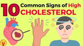 10 Common Signs of High CHOLESTEROL You SHOULD NOT Ignore  VisitJoy [upl. by Shakespeare]