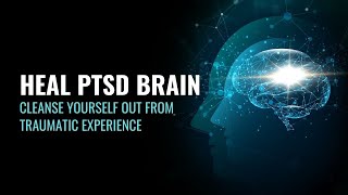 Heal PTSD Brain  Cleanse Yourself Out From Traumatic Experience  Powerful PTSD Cure  417 hz Music [upl. by Mcferren787]