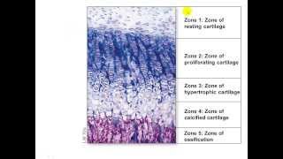 Bone Growth and Remodeling Appositional and Interstitial Growth [upl. by Vassaux]