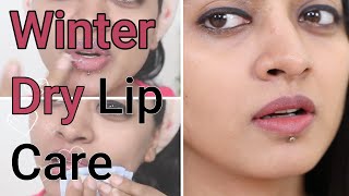 Winter Lip Care Tips  How to Prevent amp Treat Dry Lips [upl. by Ecirual311]